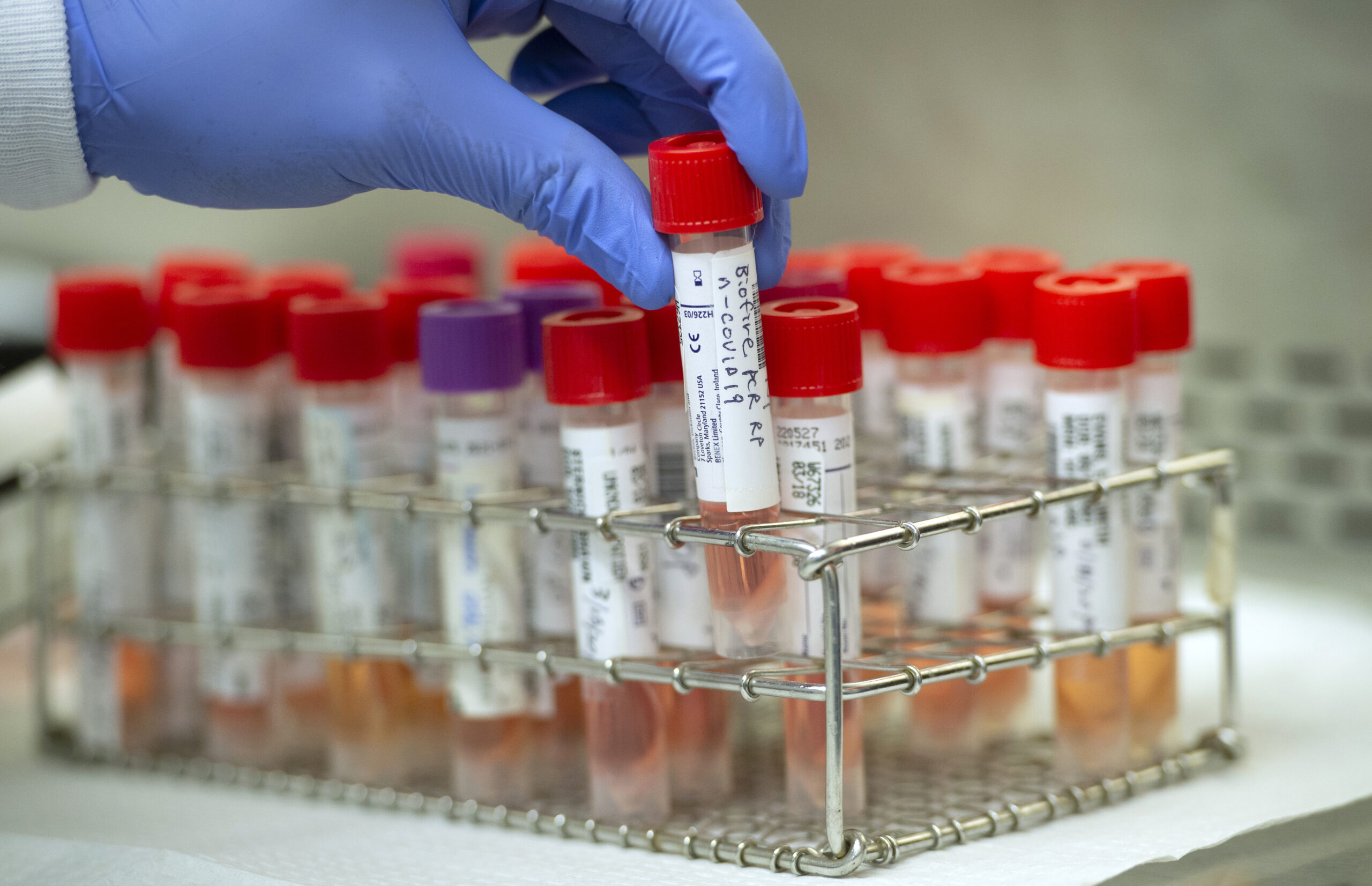 Ikizamini cya COVID-19 PCR ni iki?