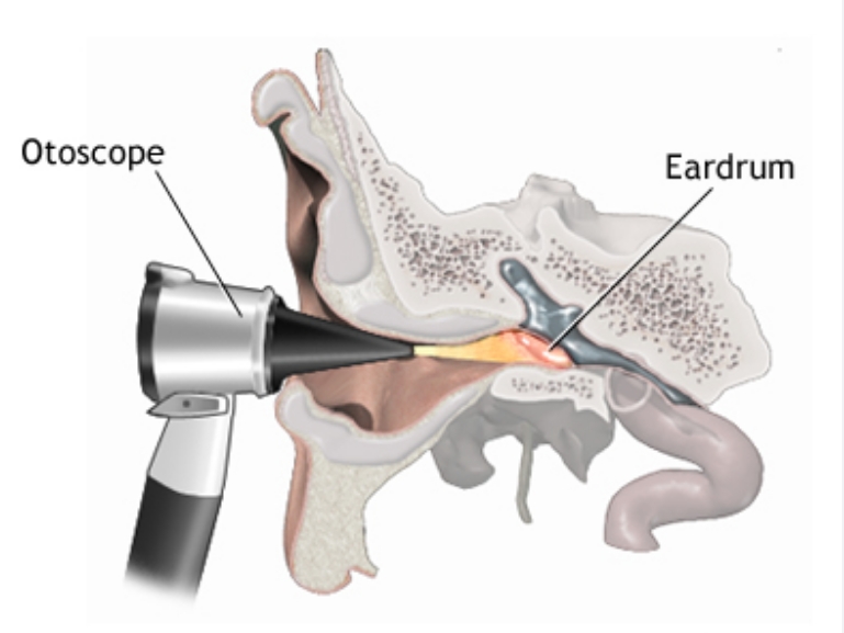 How a Simple Otoscope Specula Upholds Modern Medical Standards